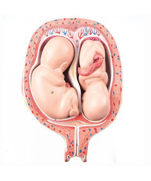 3B livmor med tvilling foster