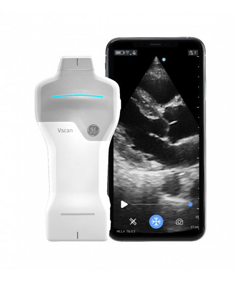 GE Vscan Air SL ultralydscanner